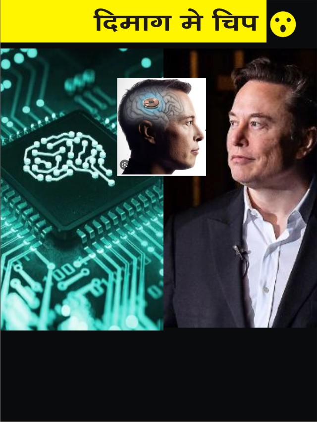 Elon Musk जब इंसानी दिमाग़ में लगाएंगे चिप  | Neuralink brain Chip